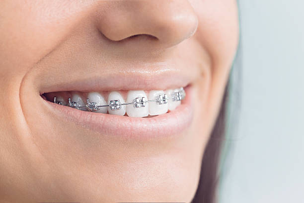 Best Veneers and Lumineers  in Shallowater, TX